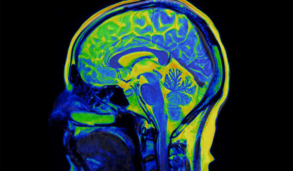 brain scan