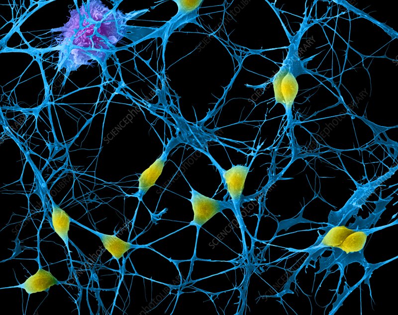 graphic image of neurons
