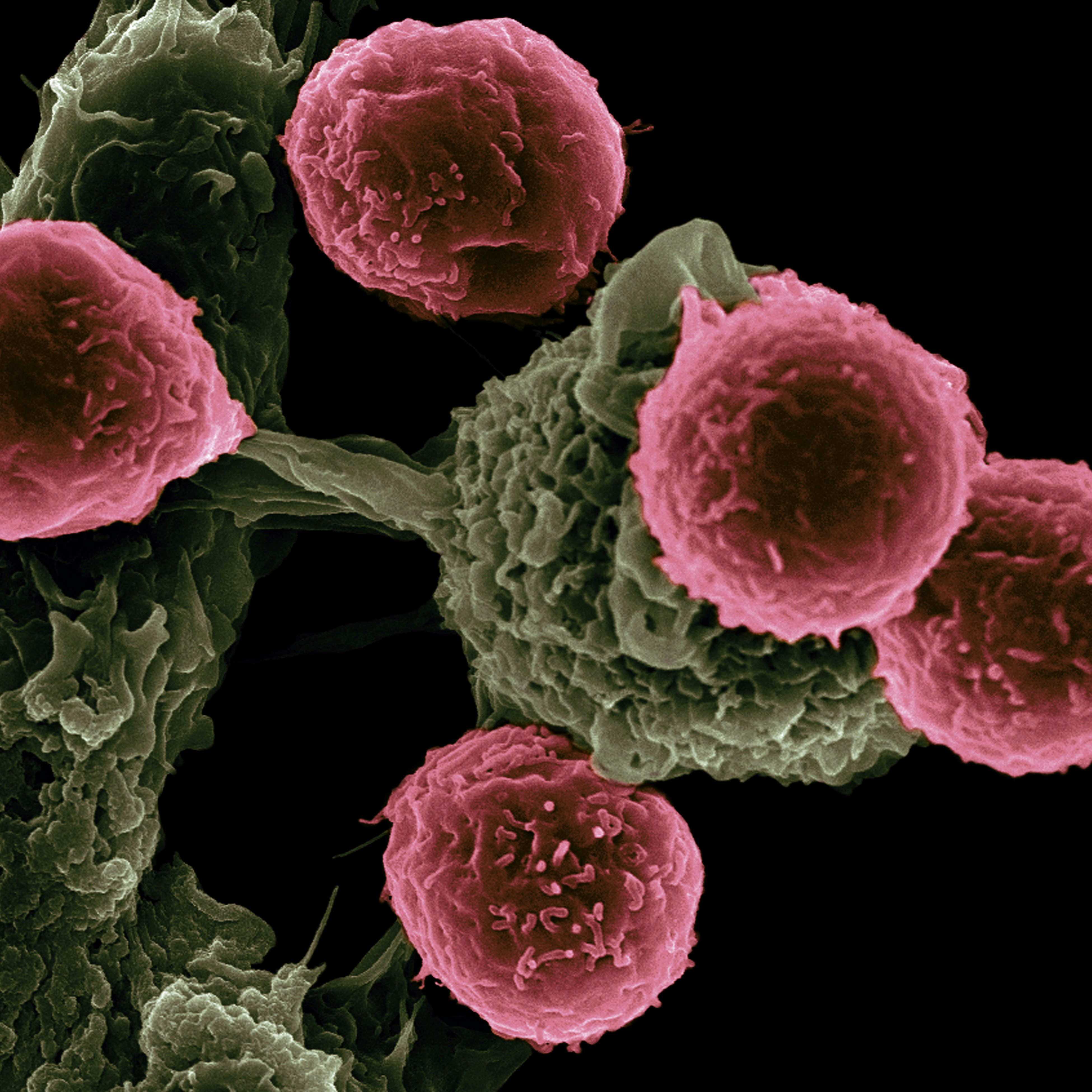 red and yellow cells in high resolution